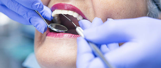 Best Emergency Dental Extractions in Beattystown, NJ